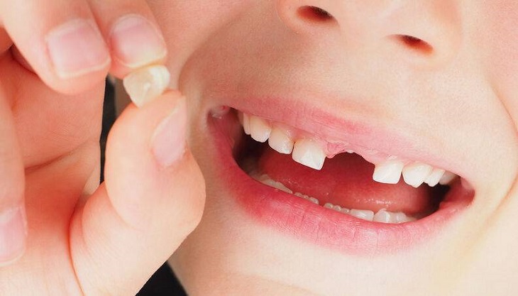 Nếu chân răng còn sót không gây đau đớn, có thể chăm sóc tại nhà