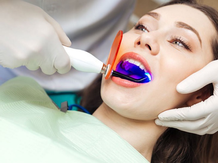 Giá tẩy trắng răng phụ thuộc vào phương pháp và địa chỉ thực hiện
