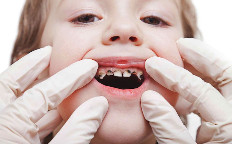 Phụ huynh nên tìm cách để trẻ có tâm lý thỏa mái, vui vẻ khi nhổ răng
