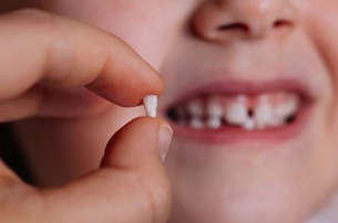 Thời điểm nhổ răng sữa thích hợp cho bé