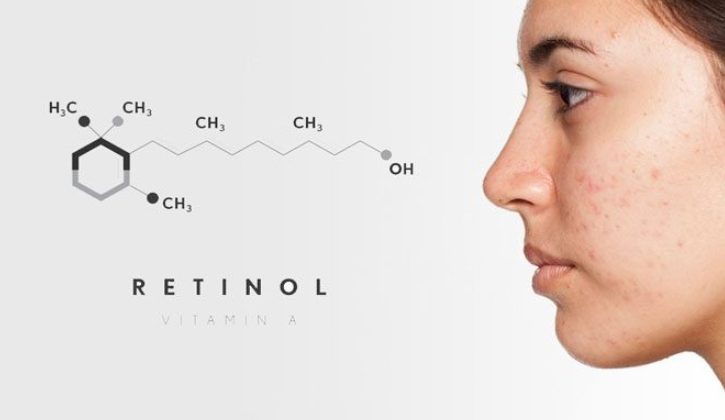 Retinol (Vitamin A) giúp cải thiện mụn, se khít lỗ chân lông hiệu quả