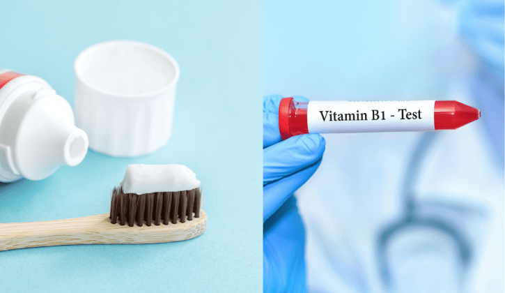 Trị nám bằng kem đánh răng và vitamin B1
