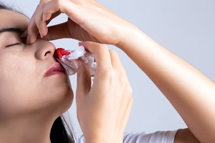 Đến gặp bác sĩ nếu tình trạng chảy máu mũi diễn ra thường xuyên, máu chảy nhiều