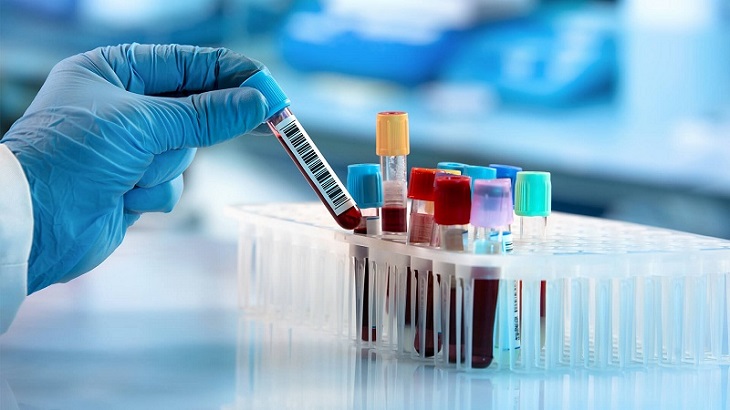 Xét nghiệm máu phát hiện chỉ số protein trong máu cao