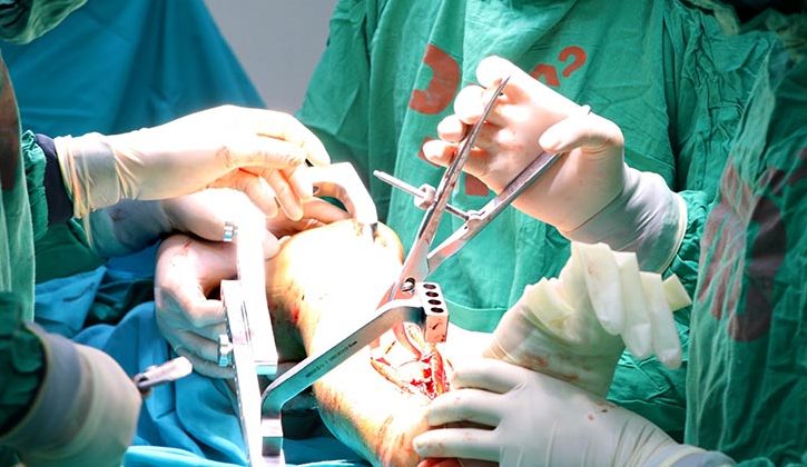 Phẫu thuật cắt bỏ gai xương giúp giải phóng các tổn thương