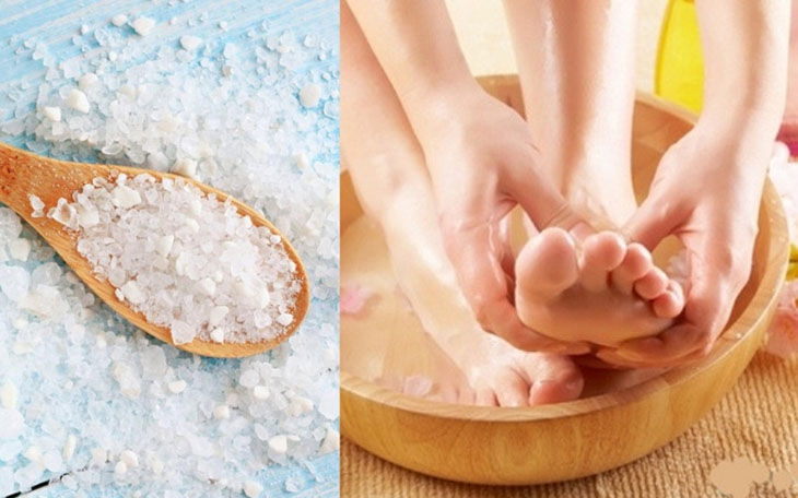 Mẹo sử dụng muối trị ra mồ hôi chân tay được dân gian sử dụng từ lâu
