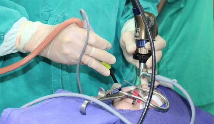 Coblator là phương pháp cắt amidan được nhiều bệnh viện áp dụng rộng rãi