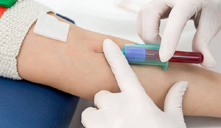 Quy trình lấy máu xét nghiệm MPV