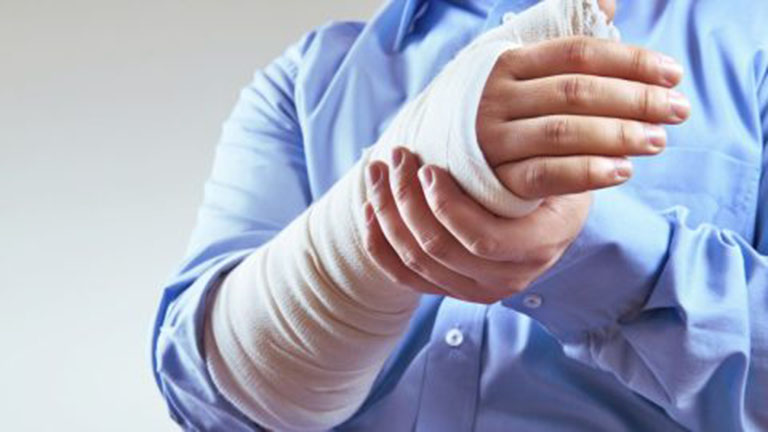 Gãy xương cánh tay là một dạng chấn thương cánh tay thường gặp