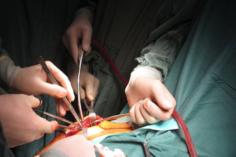Phẫu thuật thay khớp gối cần được thực hiện theo một quy trình chuẩn để đảm bảo an toàn và hiệu quả mang lại