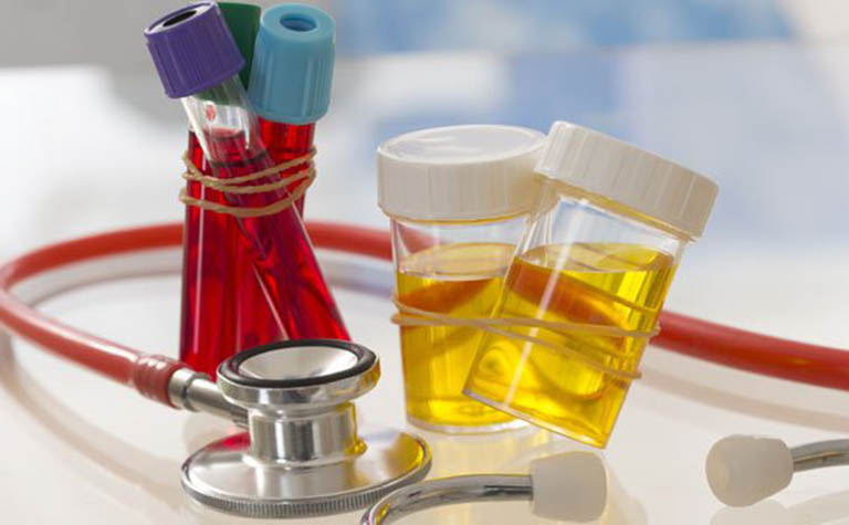 Nồng độ acid uric có thể kiểm tra thông qua xét nghiệm máu hoặc xét nghiệm nước tiểu
