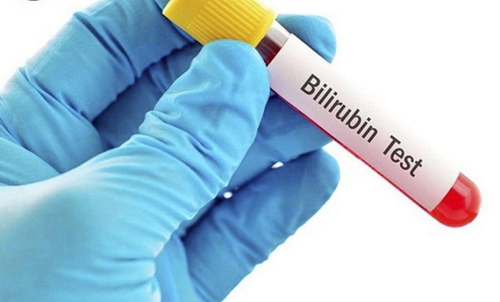 Trẻ sơ sinh ít khóc là do hàm lượng Bilirubin trong máu cao hơn bình thường