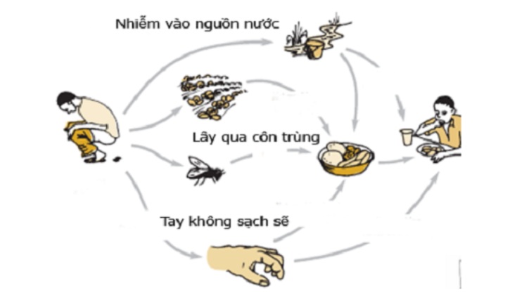 Viêm gan A dễ dàng lây nhiễm qua đường phân - miệng