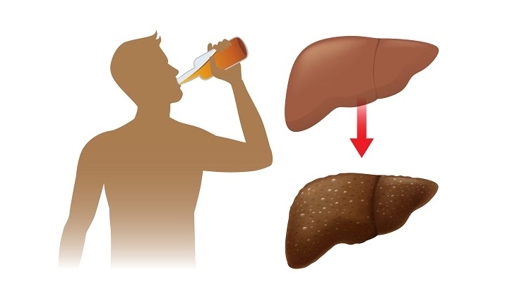 Bị viêm gan B tuyệt đối không nên uống rượu bia