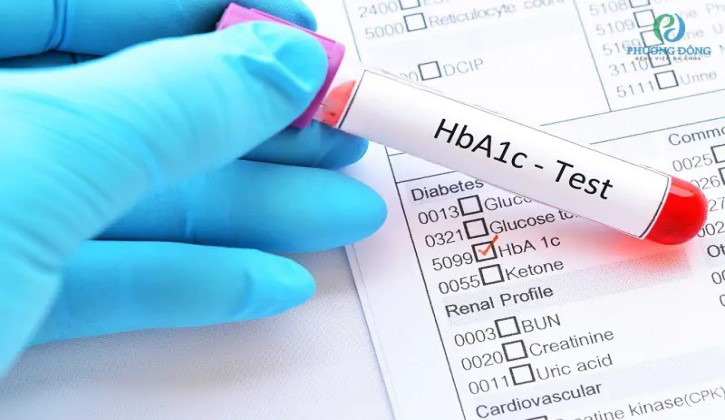 Xét nghiệm Hba1c giúp kiểm tra định kỳ hàm lượng đường trong máu