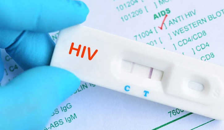 Xét nghiệm HIV sau ít nhất 2 – 3 tháng mới có kết quả chính xác