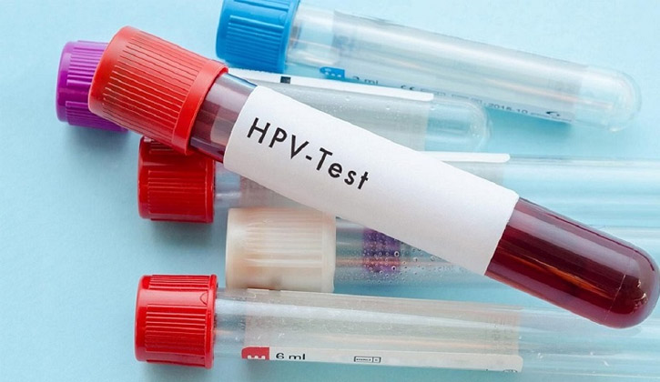 Xét nghiệm HPV có khả năng tầm soát và phát hiện ra virus HPV ở nữ giới