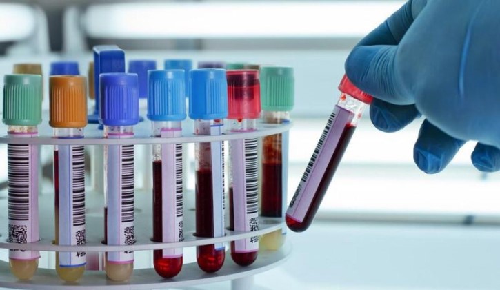 Xét nghiệm máu và phân tích các chỉ số, bác sĩ có thể tìm ra mầm bệnh