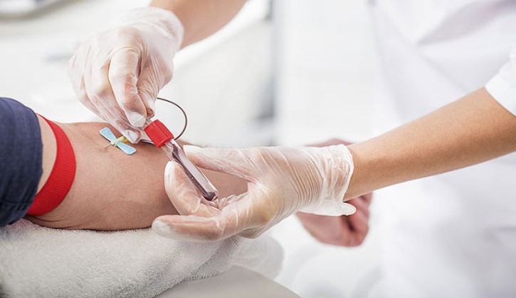 Xét nghiệm máu phát hiện dương tính với vi khuẩn Hp nếu trong máu người bệnh có sự hiện diện của kháng thể Hp