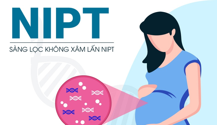 Xét nghiệm NIPT là phương pháp không xâm lấn