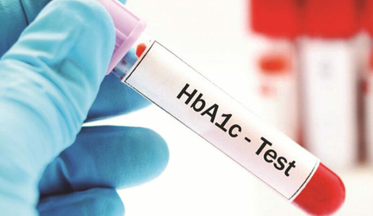 Xét nghiệm HbA1C