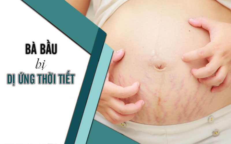 Bà bầu bị dị ứng thời tiết là tình trạng thường gặp