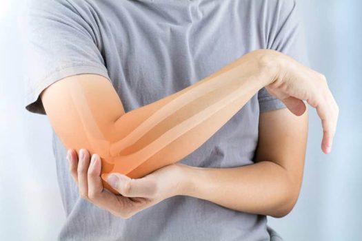 Đau khuỷu tay gây ra nhiều khó chịu cho người bệnh và làm giảm khả năng vận động