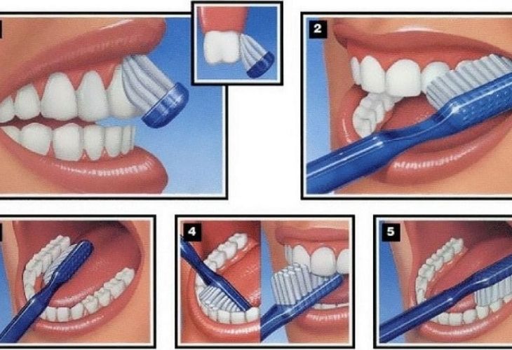 Vệ sinh răng miệng đúng cách là biện pháp phòng ngừa đau răng tốt nhất.