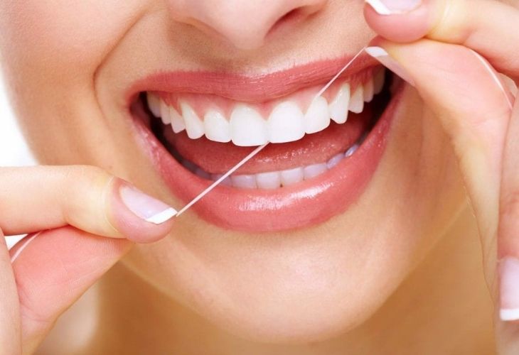Bạn nên sử dụng chỉ nha khoa để vệ sinh sạch sẽ thức ăn còn sót lại giữa các kẽ răng