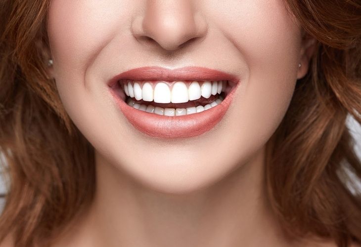 Tẩy trắng là phương pháp chỉ có thể áp dụng với răng thật