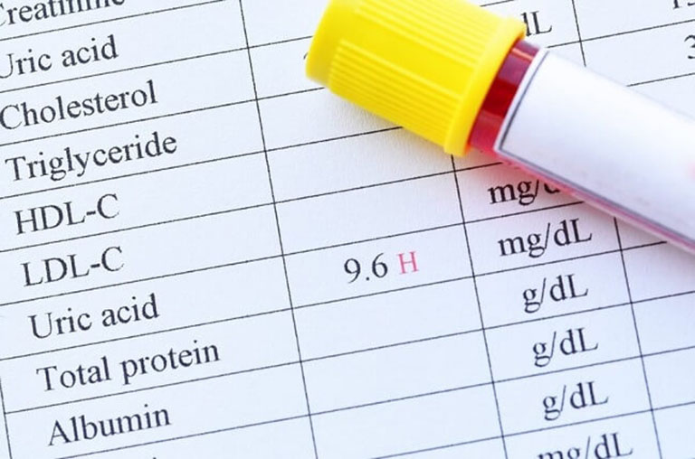 Chỉ số acid uric trong máu tăng cao sẽ gây ra nhiều bất thường về sức khỏe