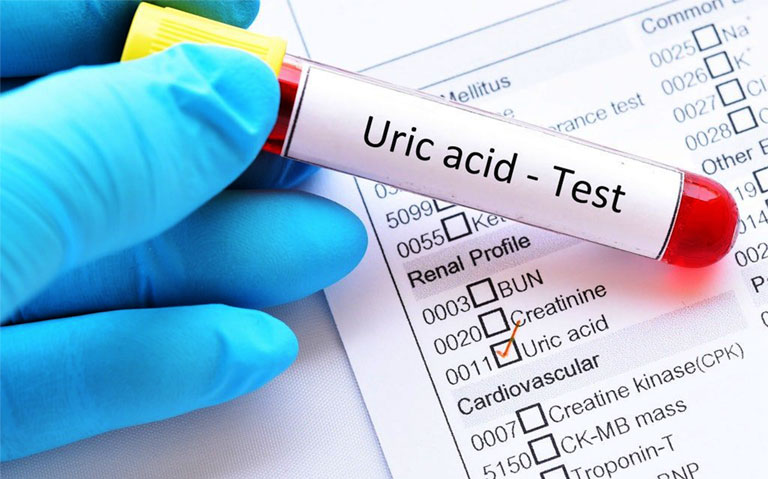 Chỉ số acid uric trong máu bình thường và bất thường là như thế nào?