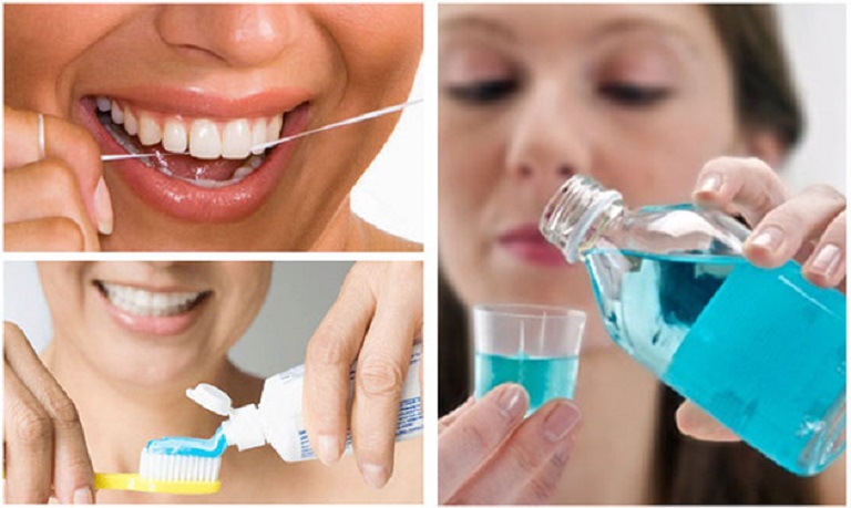 Vệ sinh răng miệng sạch sẽ để đảm bảo sức khỏe răng miệng tốt nhất