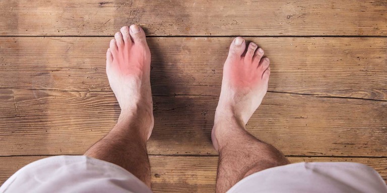 Hoạt chất trong lá sa kê có tác dụng làm giảm các triệu chứng khó chịu do bệnh gout gây ra