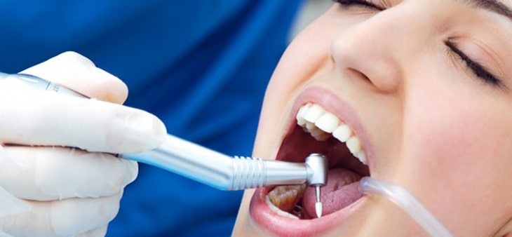 Quy trình cấy răng Implant được thực hiện trong phòng vô trùng