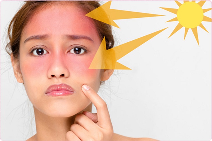 Thoa kem chống nắng sẽ giúp bảo vệ da khỏi những tác hại của tia UV