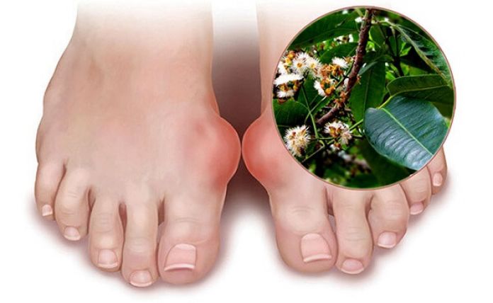 Sử dụng lá vối để chữa bệnh gout được khá an toàn và lành tính đối với cơ thể
