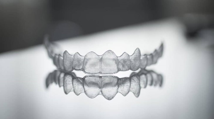 Niềng răng vô hình Invisalign thường có mức giá thành rất cao