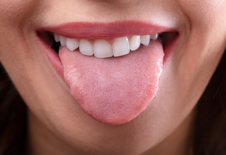 Dùng lưỡi đẩy răng là một trong những cách niềng răng tại nhà được nhiều người áp dụng