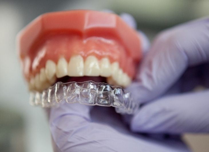 Bạn nên tìm hiểu thật kỹ về phương pháp niềng răng tháo lắp trước khi thực hiện