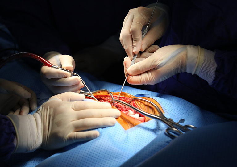 Phẫu thuật chỉnh vẹo cột sống cần được thực hiện theo đúng quy trình để đảm bảo an toàn