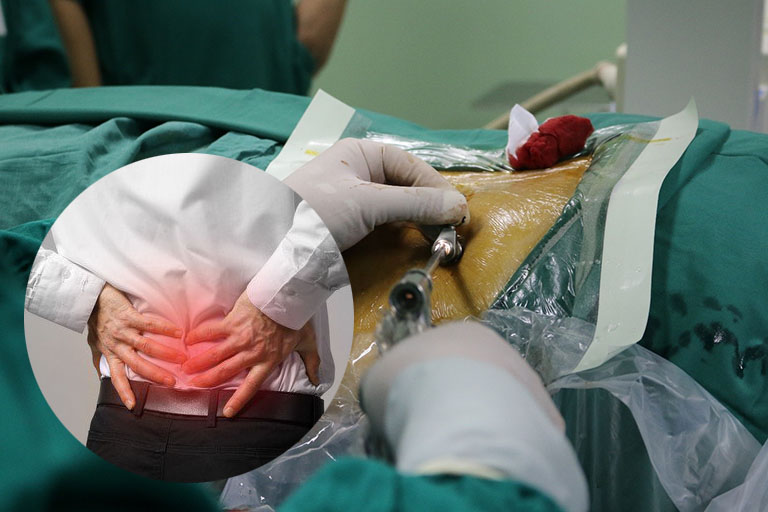 phẫu thuật thoát vị đĩa đệm cột sống thắt lưng