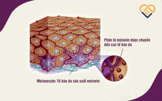 Sắc tố melanin - con dao hai lưỡi của mọi làn da