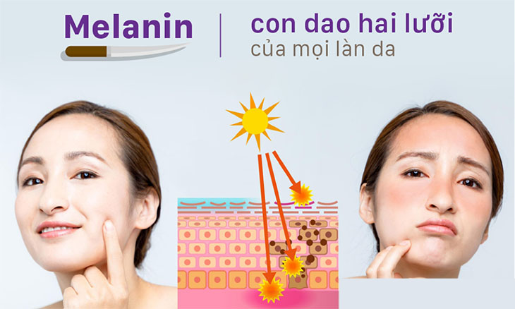Sắc tố melanin tồn tại ở trạng thái cân bằng còn có lợi ích giúp bảo vệ da khỏi tia UV từ ánh nắng mặt trời