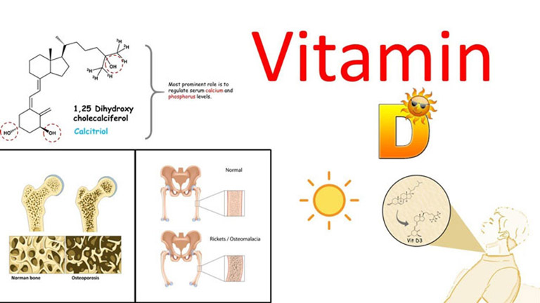 thiếu vitamin D trẻ bị còi xương