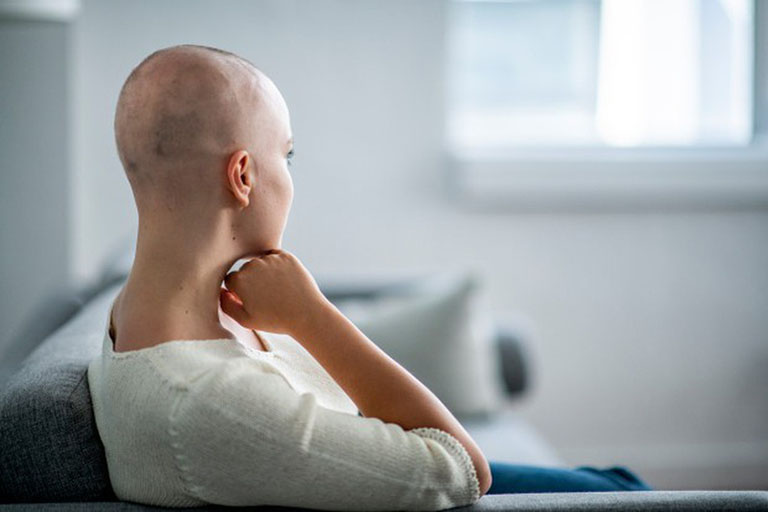 Dùng thuốc hóa trị điều trị ung thư xương sẽ gây ra tình trạng mất tóc