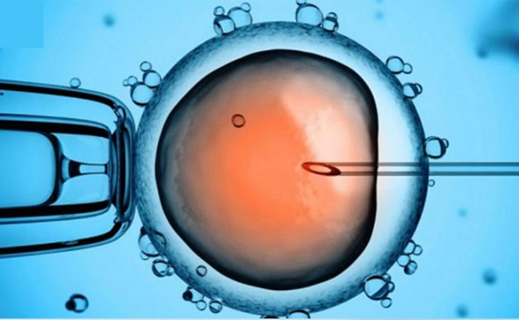IUI- Giải pháp hỗ trợ sinh sản hiện đại tinh trùng yếu vẫn có thai