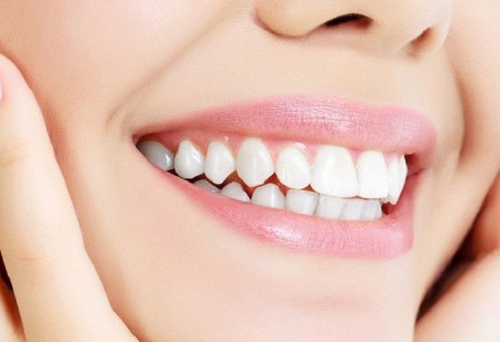 Trồng răng bắc cầu giúp bạn lấy lại sự tự tin khi cười