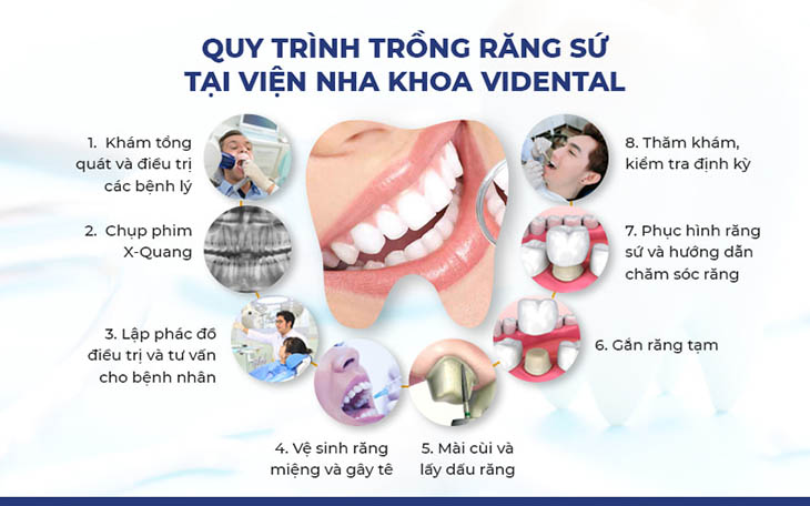 ViDental là đơn vị được đông đảo người bệnh lựa chọn phục hình răng