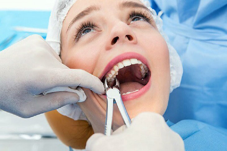 Trồng răng giả không gây đau đớn trong quá trình thực hiện